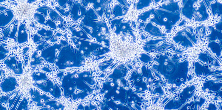 glioblastoma oncolytic virus transgene 2