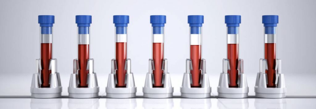 liquid biopsy acquisition angle 1