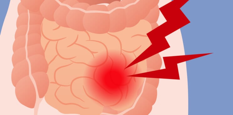 tigenix crohns disease orphan2 1