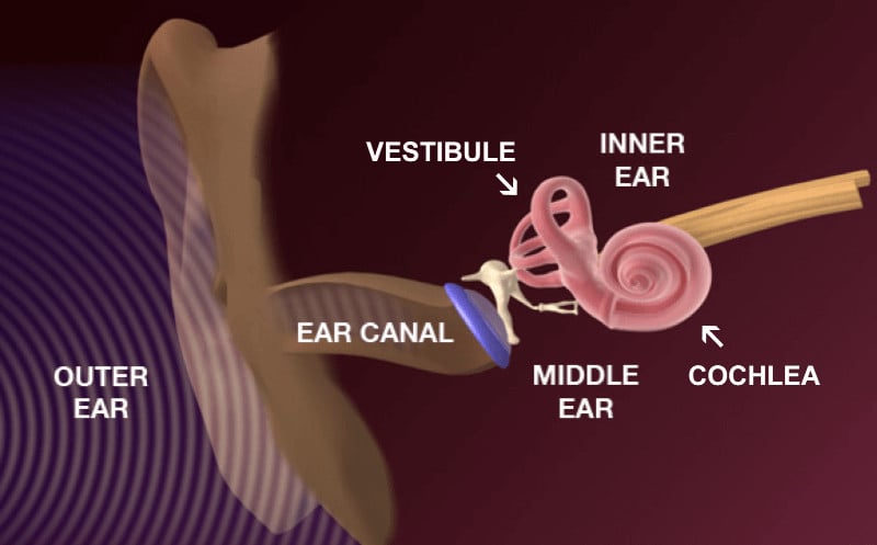 hearing loss