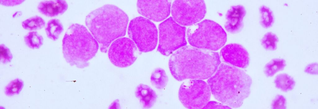 leukemia drug genmab novartis 1