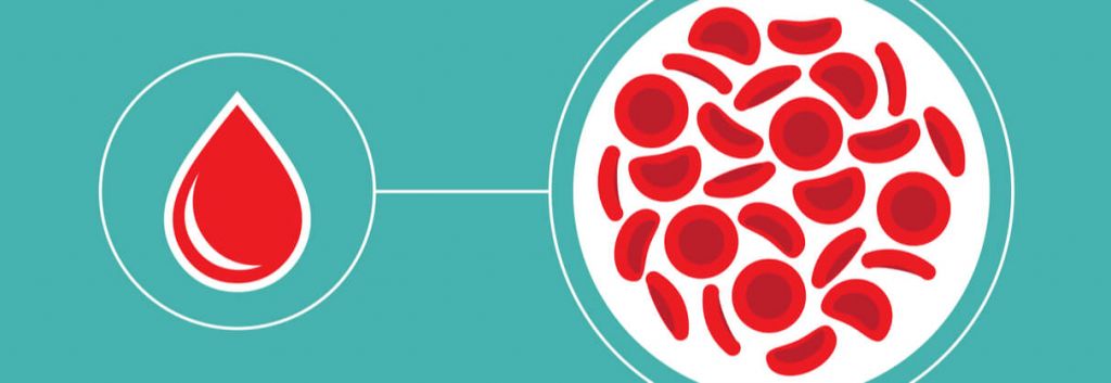 liquid biopsy prostate cancer angle 1