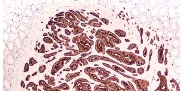 tc biopharm