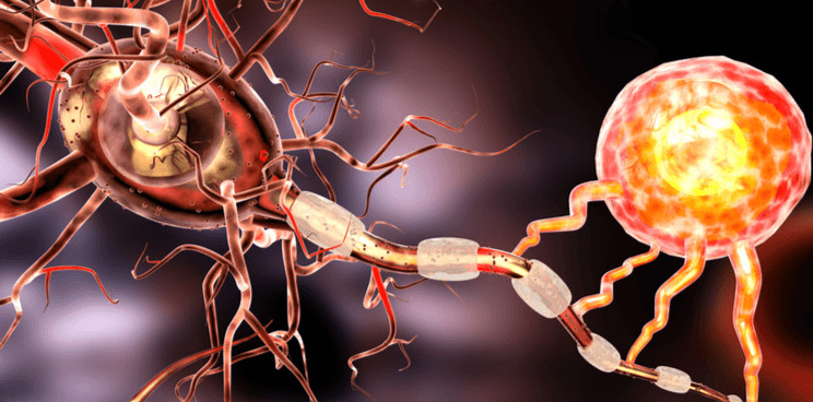 multiple sclerosis antibody CIDP geneuro 1