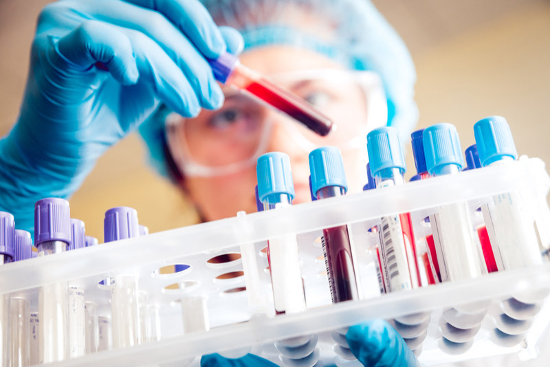 A New Liquid Biopsy Can Improve Ovarian Cancer Diagnosis