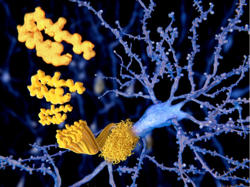 Can Morphosys Decrease Amyloid Beta in the Brains of Alzheimer's Patients?