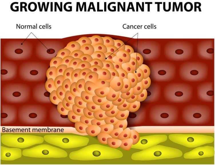 UK Biotech Raises €73M to Target DNA Repair in Treating Cancer