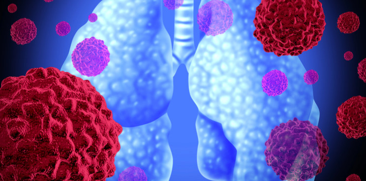 Forbion Lung Disease Small Cover Image