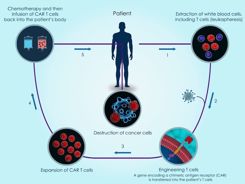 Celyad’s CAR-T Therapy Gets Closer to the Clinic