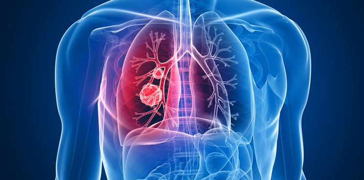 io biotech startup novo seeds immunotherapy ventures lung cancer