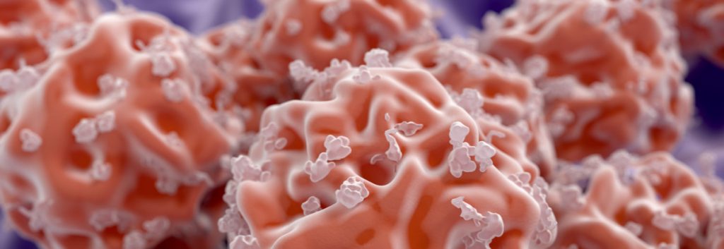 Xenikos Graft Versus Host Disease