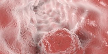 Cardiovascular Drug Could Deliver Esophageal Cancer Treatments