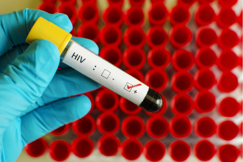 London Biotech Rakes in Positive Results for Two HIV Treatment Phase III Trials