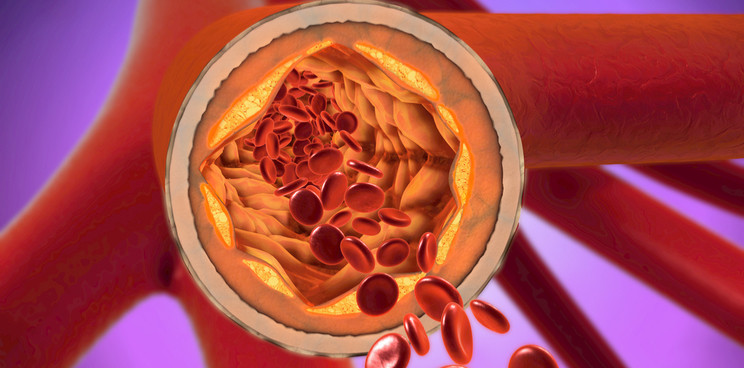 Idorsia Arterial Constriction