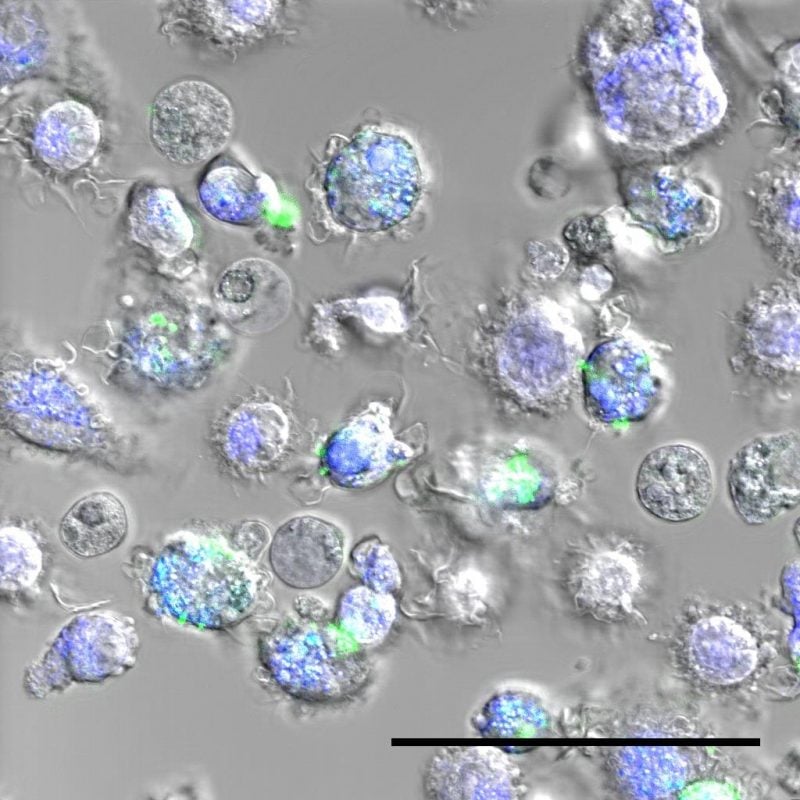 Immune cells that ingested spider silk nanoparticles (in green). The endosomes - the part of the cell in which the nanoparticles release the vaccine - appear in blue. (35)