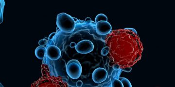 Sangamo Acquires French CAR-T Technology for Autoimmune Diseases