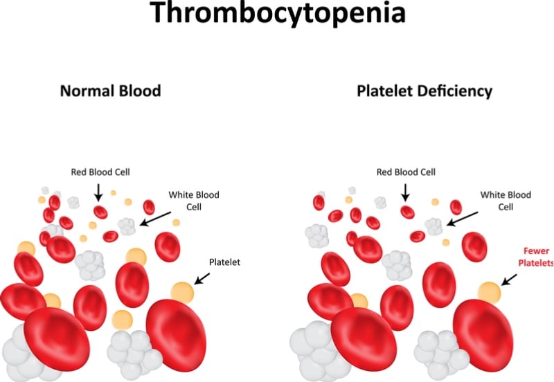 Argenx - thrombocytopenia