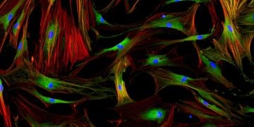 Galecto lung disease fibroblasts header