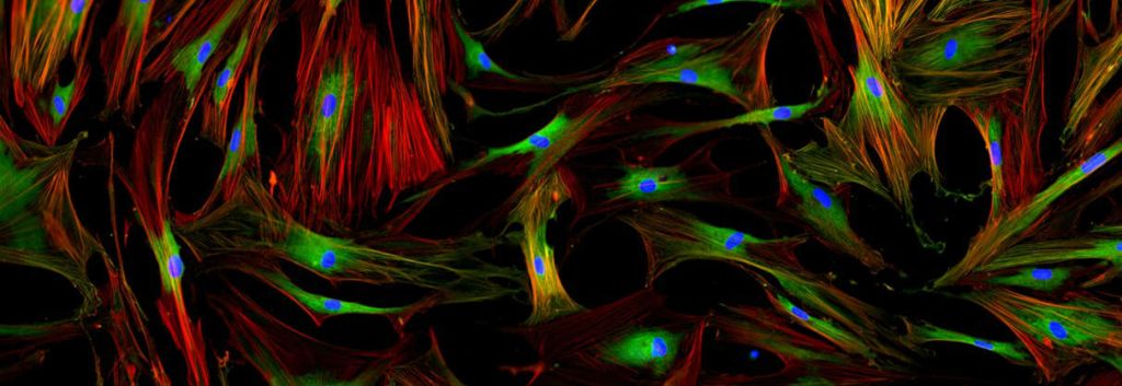 Galecto lung disease fibroblasts header