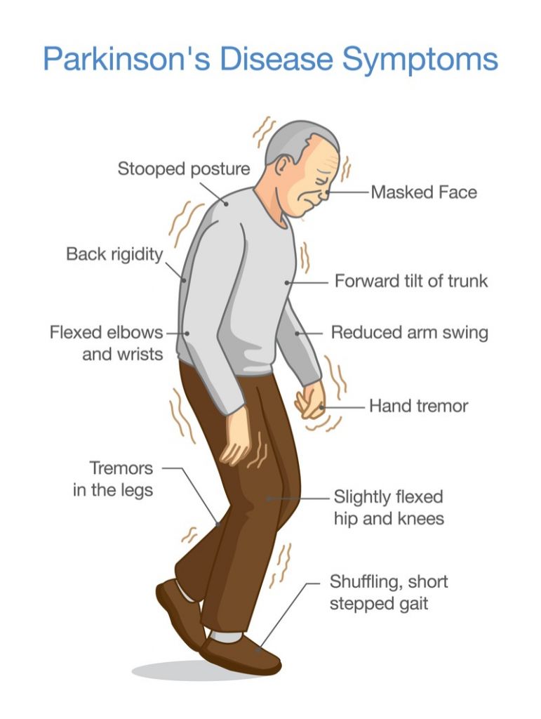 axovant Parkinson's disease motor symptoms