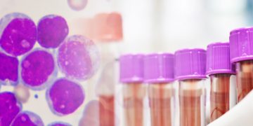 hybrigenics pharma leukemia lab