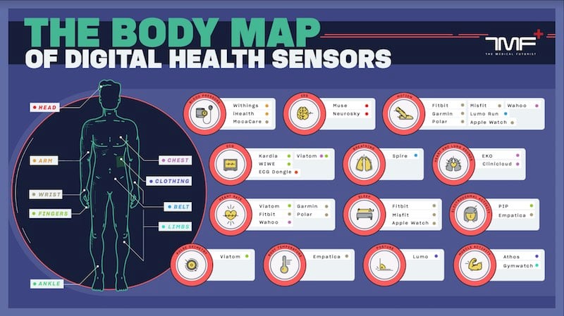 Biosensors