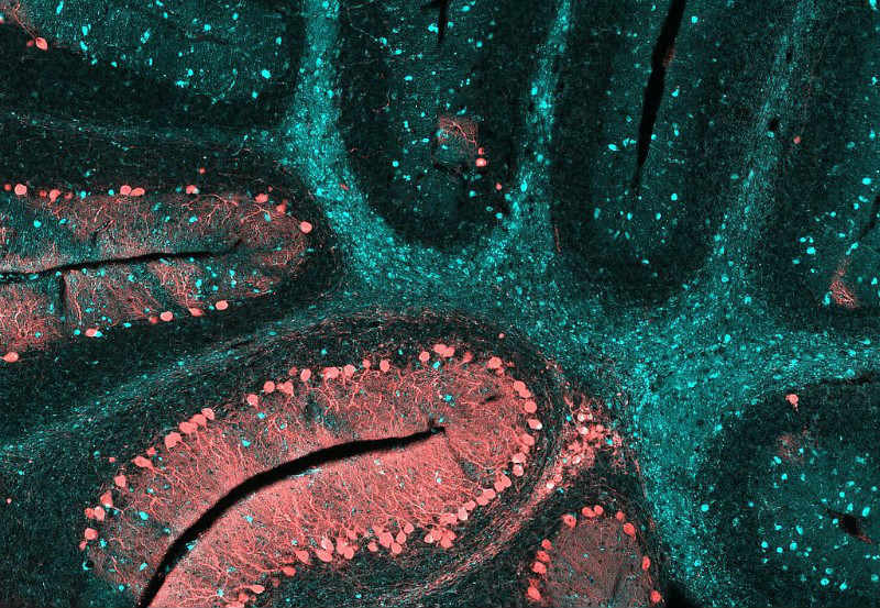 orphazyme rare disease lysosome niemann-pick type c