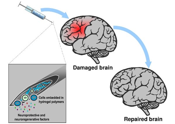 silk fibroin biomaterial stroke stem cells