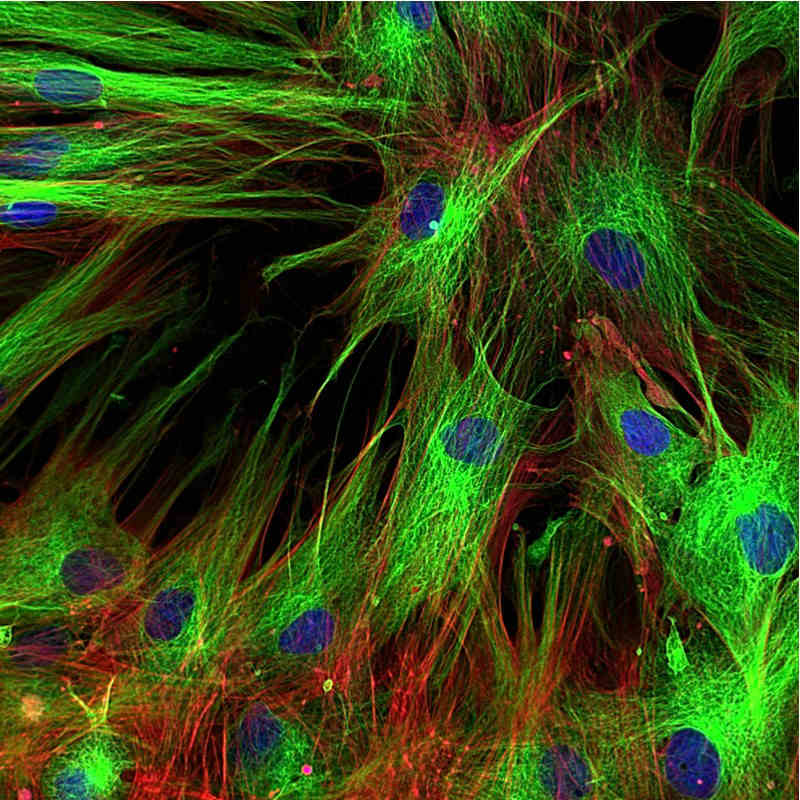 cancer immunotherapy skin fibroblast