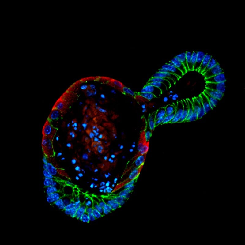 sun biosciences organoid cystic fibrosis