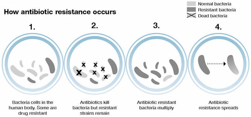 Antimicrobial resistance