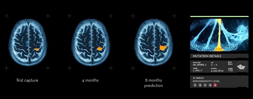 SOPHiA GENETICS AI cancer radiomics imaging