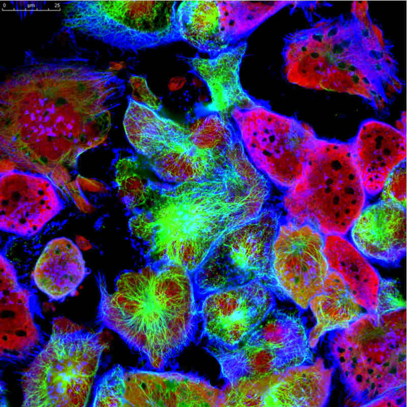 arctoris automation cancer tumor cell