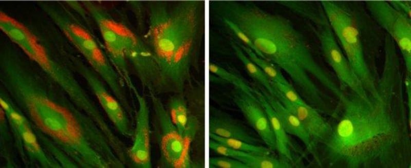 orphazyme niemann-pick type c disease rare metabolic disease drug