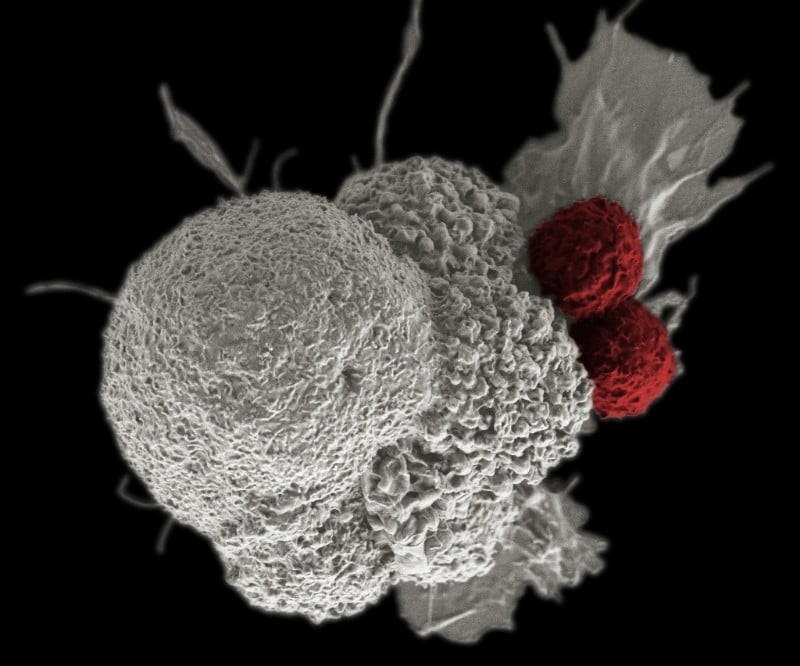 car-t cancer immunotherapy