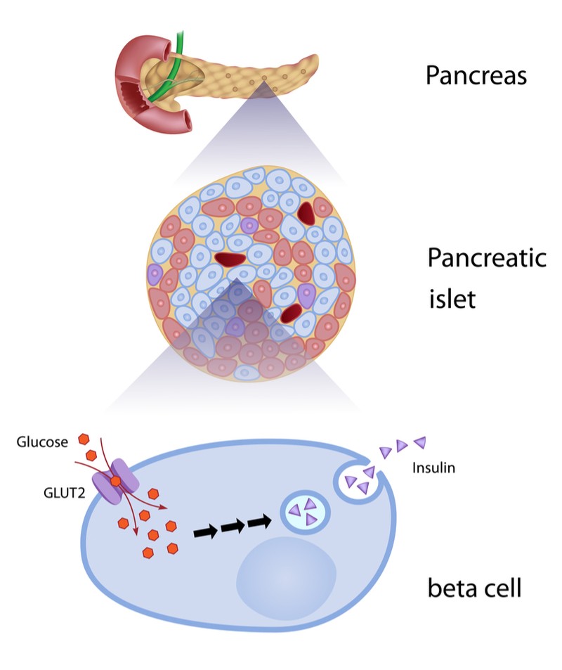 follicum diabetes insulin hair loss beta cell