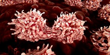 cell therapy ada-scid orchard therapeutics