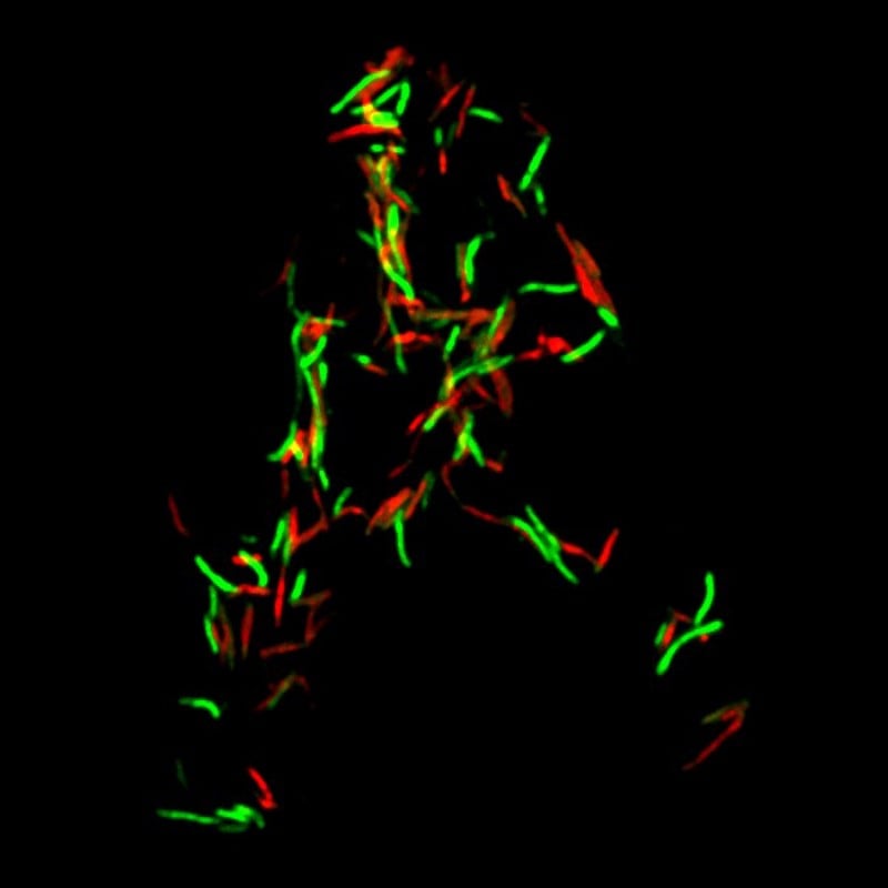 tuberculosis suicide cnrs embl Francis Crick