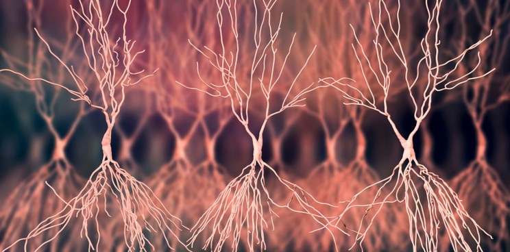 bioarctic alzheimers disease plaques amyloid beta neurons Edited