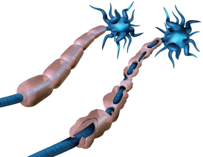 geneuro multiple sclerosis treatment neuron