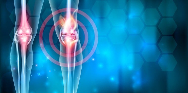 osteoarthritis stem cell regenerative medicine