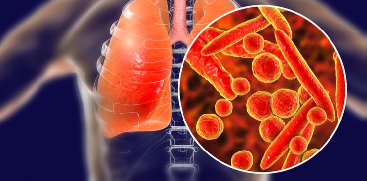 combioxin antibiotic resistance pneumonia