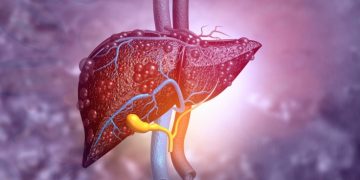 liver disease genkyotex fibrosis cirrhosis
