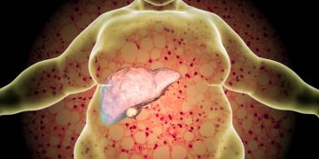 liver disease nash promethera