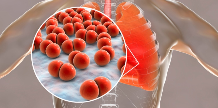 pneumonia lungs polyphor antibiotic resistance