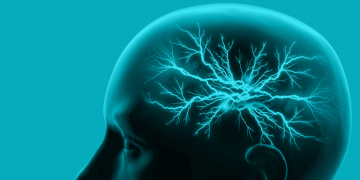 schizophrenia brain drugs antipsychotics