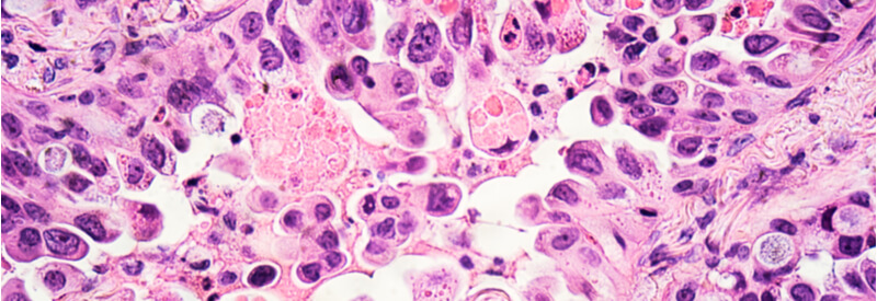 tissue exposure, 5R's concept, drug development