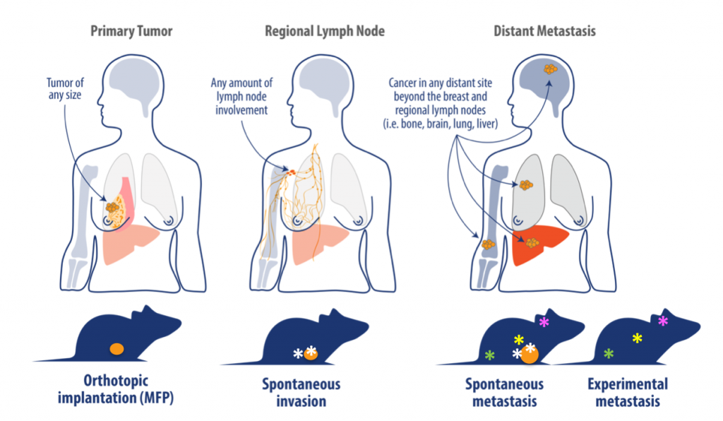 breast cancer, orthotopic tumor model, breast cancer development