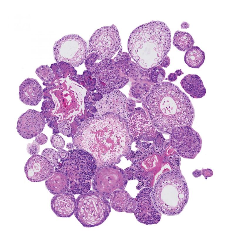organoids hubrecht institute head and neck cancer