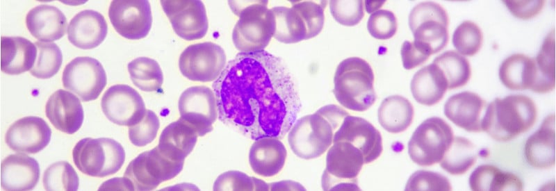 monocytes, monocytes in blood smear, monocyte activation test